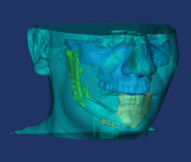 3D επανορθωτική και πλαστική χειρουργική, μόνο στο Metropolitan
