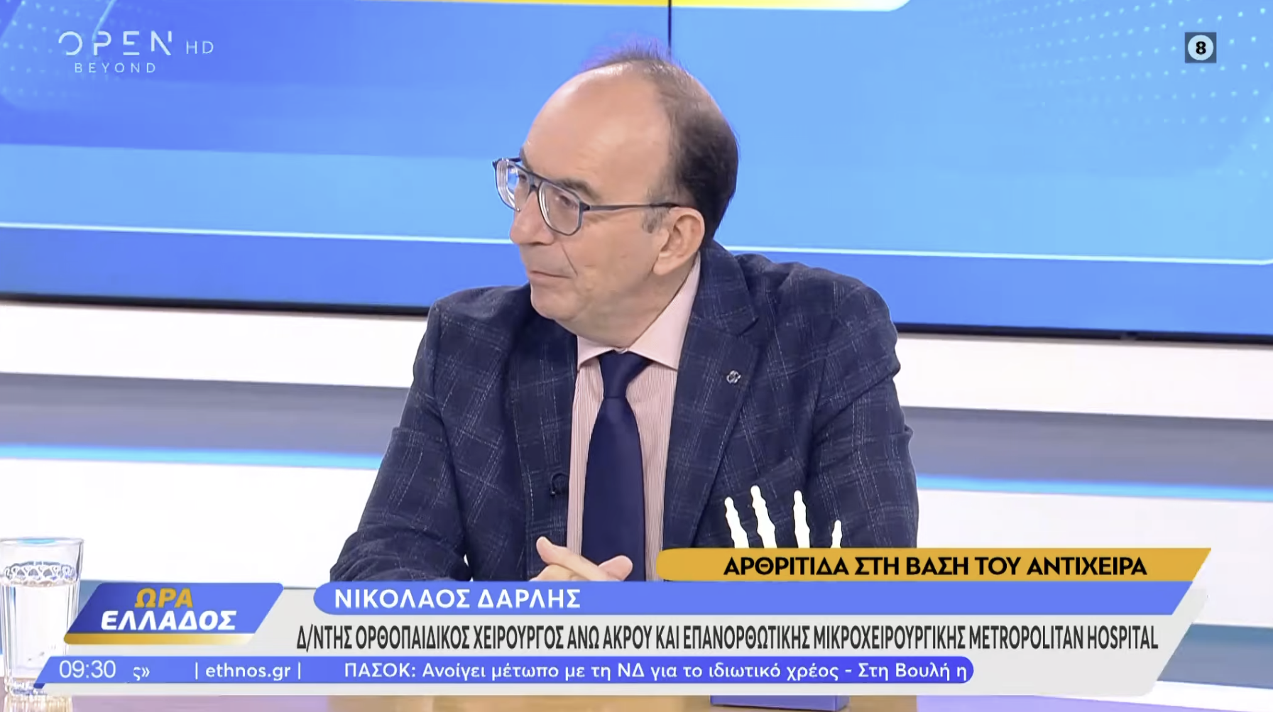 Νικόλαος Δαρλής | Αρθρίτιδα Αντίχειρα: Από τον Συνεχή Πόνο στην Ταχεία Αποκατάσταση