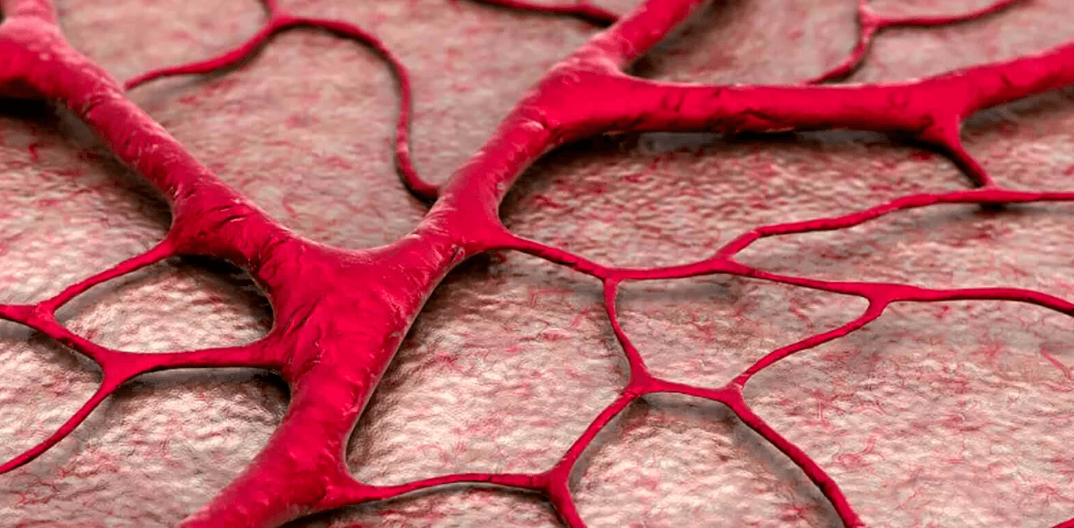 Κληρονομική Αιμορραγική Τηλεαγγειεκτασία