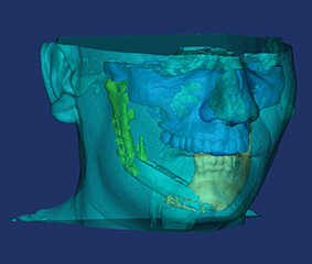 3D επανορθωτική και πλαστική χειρουργική, μόνο στο Metropolitan