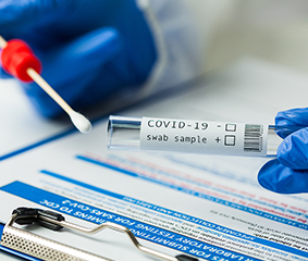 Νέα αναθεωρημένη τιμή για το Test Covid-19 με τη μοριακή μέθοδο (PCR) από 06/01/2022
