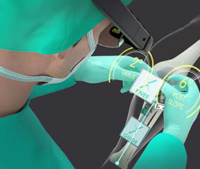 PIXEE ΚΝΕΕ+, σύστημα τεχνολογίας επαυξημένης πραγματικότητας για την ολική αρθροπλαστική γόνατος στο Metropolitan Hospital