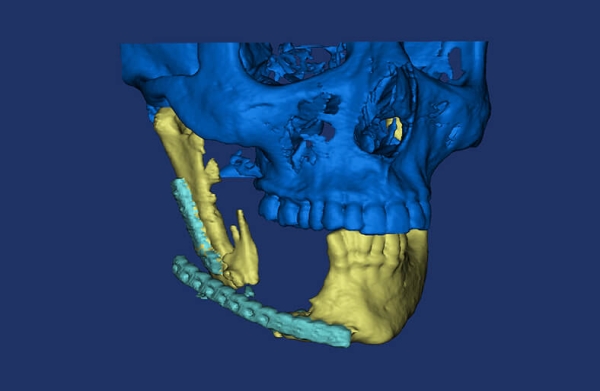 3D-plastikh_1