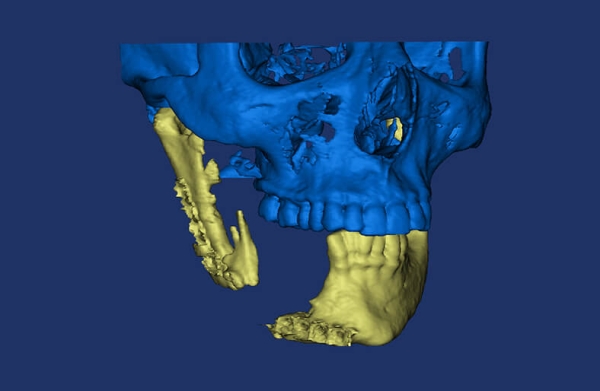 3D-plastikh_2