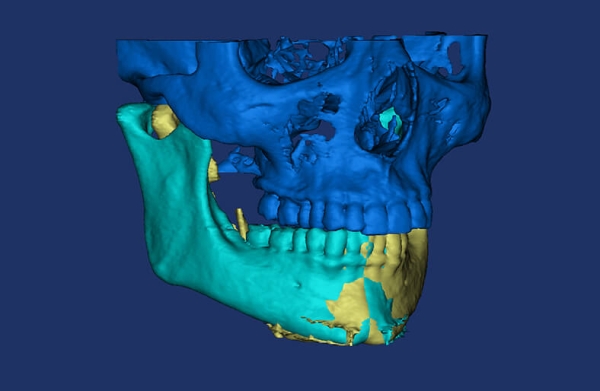 3D-plastikh_3