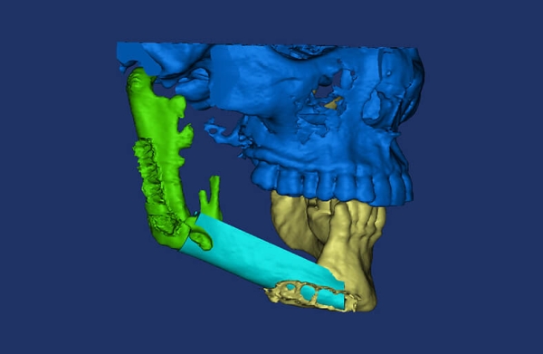 3D-plastikh_4
