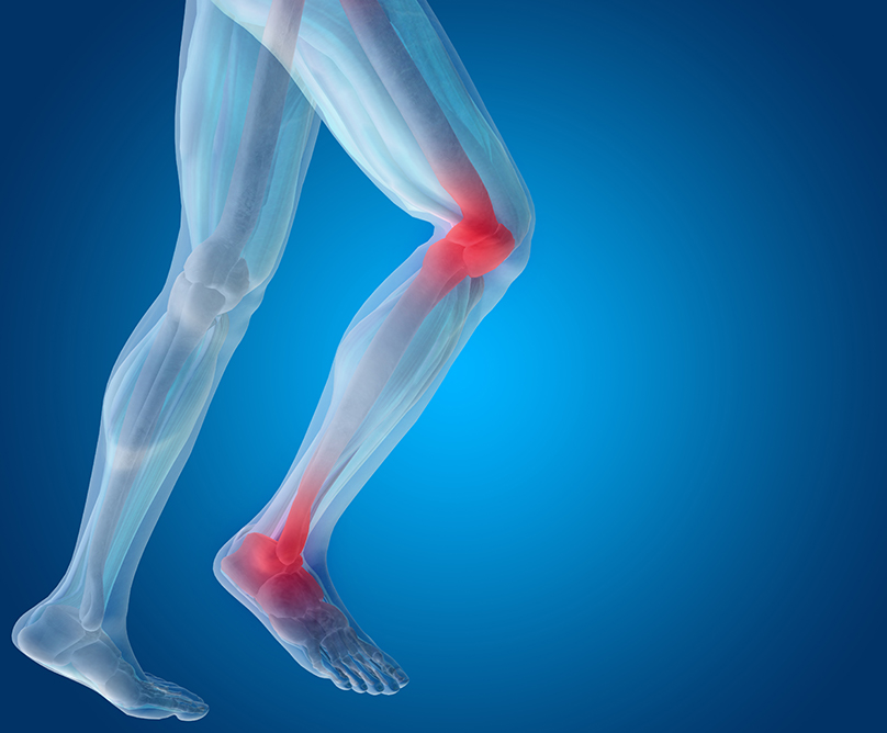 Παθήσεις αρθρικού χόνδρου: οι νεότερες εξελίξεις στην αντιμετώπισή τους