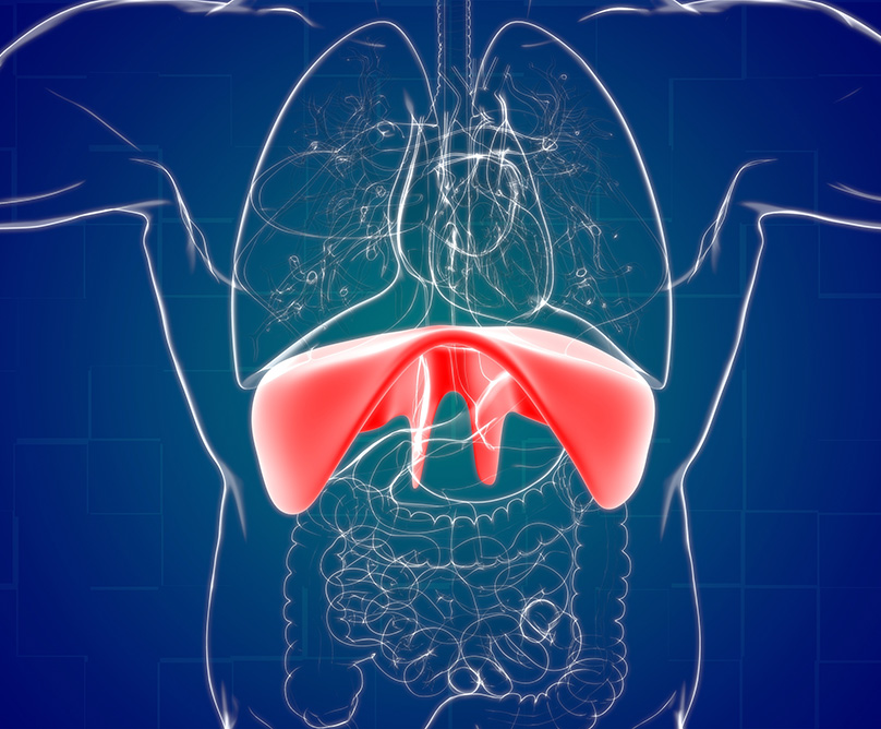 Τι είναι η διαφραγματοκήλη και ποια είναι η θεραπεία;