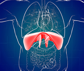 Τι είναι η διαφραγματοκήλη και ποια είναι η θεραπεία;