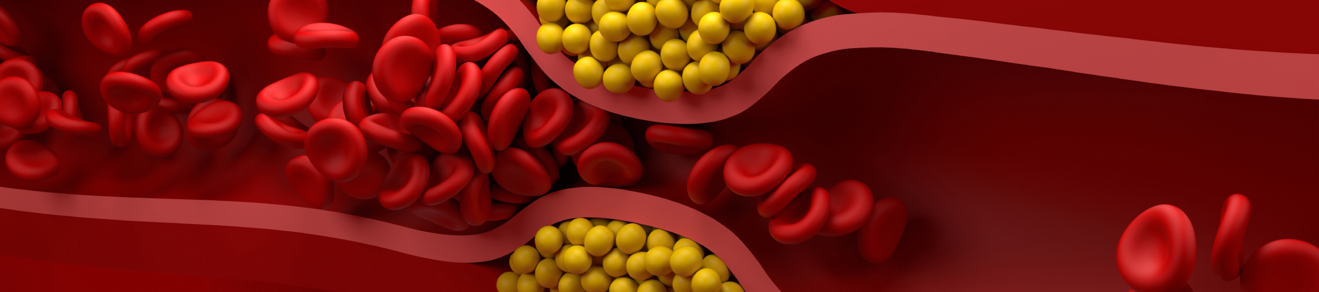 Υπερχοληστερολαιμία: ένας «ύπουλος» εχθρός