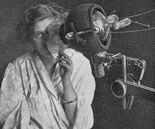 Συσκευή ακτίνων-Χ για τη θεραπεία επιθηλιώματος προσώπου, γύρω στα 1915