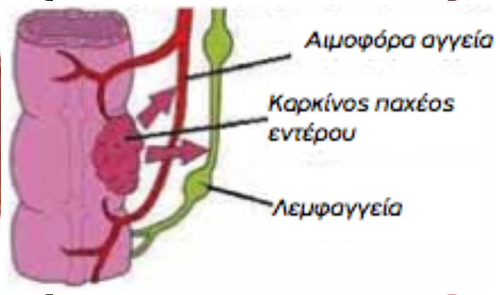 blog karkinos enterou 14