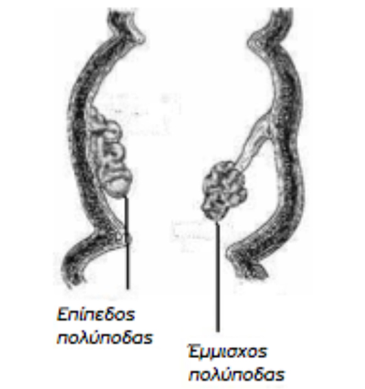 blog karkinos enterou 6