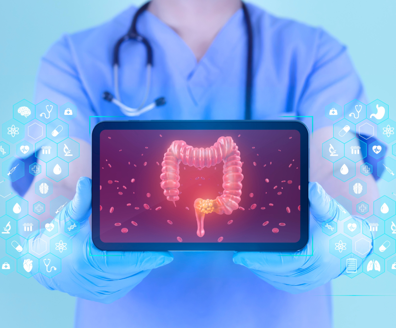 Ο καρκίνος του παχέος εντέρου και η θεραπευτική του αντιμετώπιση