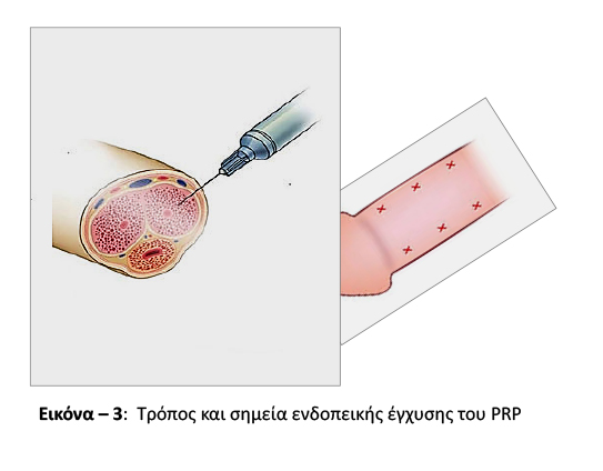 blog spuropolos img 3