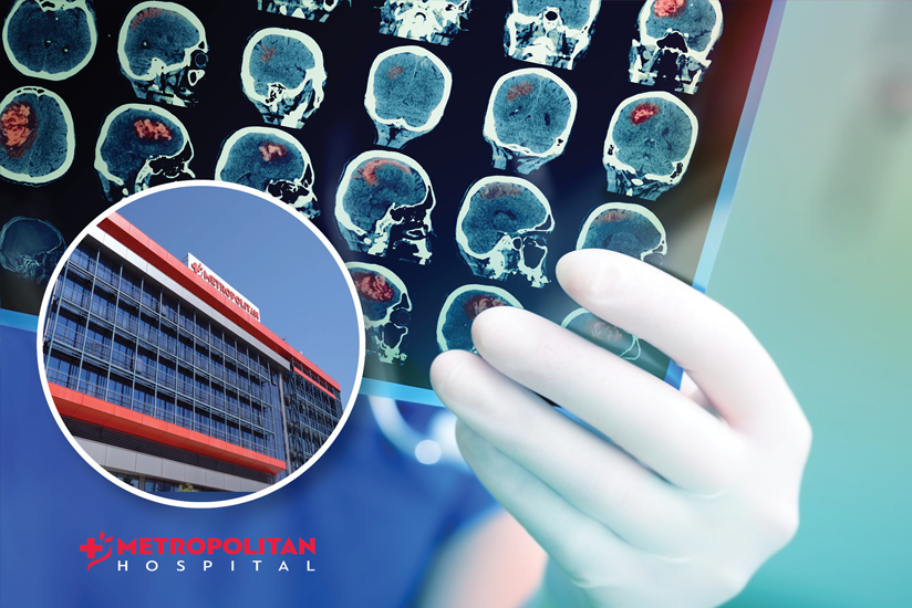 Η τεχνητή νοημοσύνη στην αντιμετώπιση εγκεφαλικών επεισοδίων στο Metropolitan Hospital