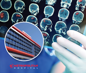 Η τεχνητή νοημοσύνη στην αντιμετώπιση εγκεφαλικών επεισοδίων στο Metropolitan Hospital