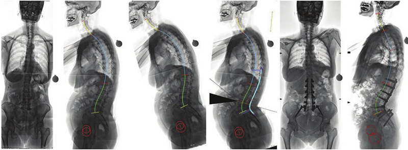 Προεγχειρητική εικόνα