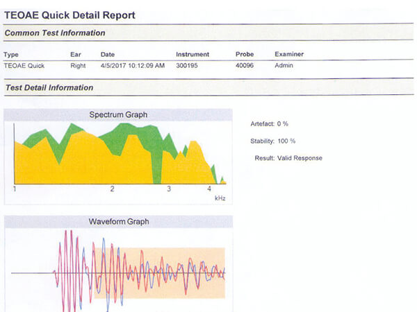 Εικόνα παθολογικών Προκλητών Ωτοακουστικών Εκπομπών