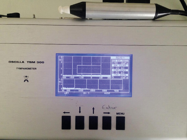 Ηλεκτρονικός Τυμπανογράφος