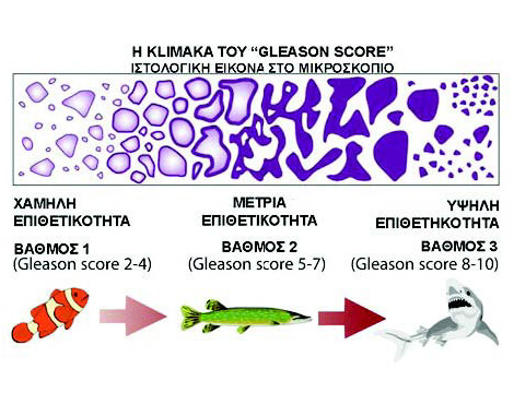 Κλίμακα του Gleason score