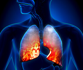 Οι λοιμώξεις του αναπνευστικού συστήματος