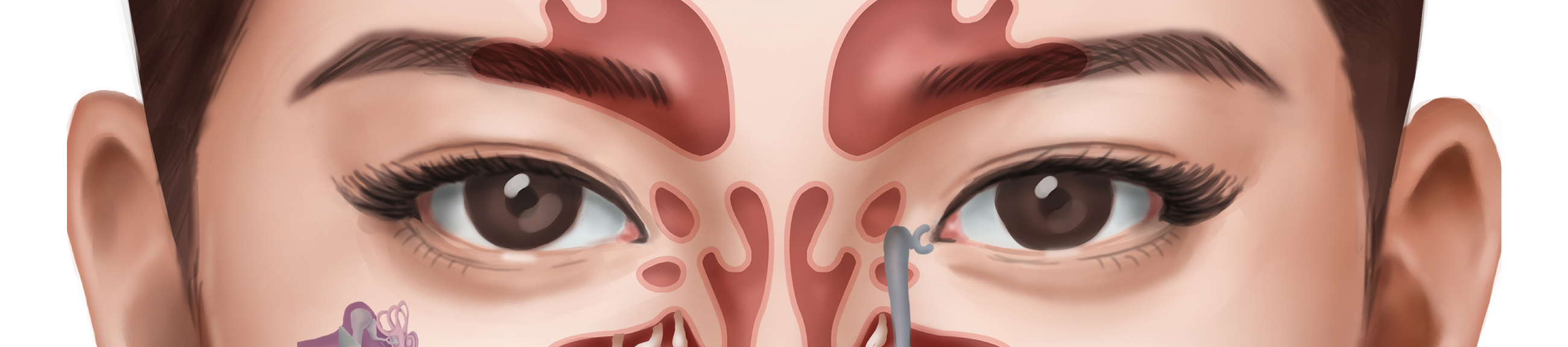 Ρινικοί πολύποδες: ο ρόλος της ενδοσκοπικής χειρουργικής στη σύγχρονη αντιμετώπισή τους