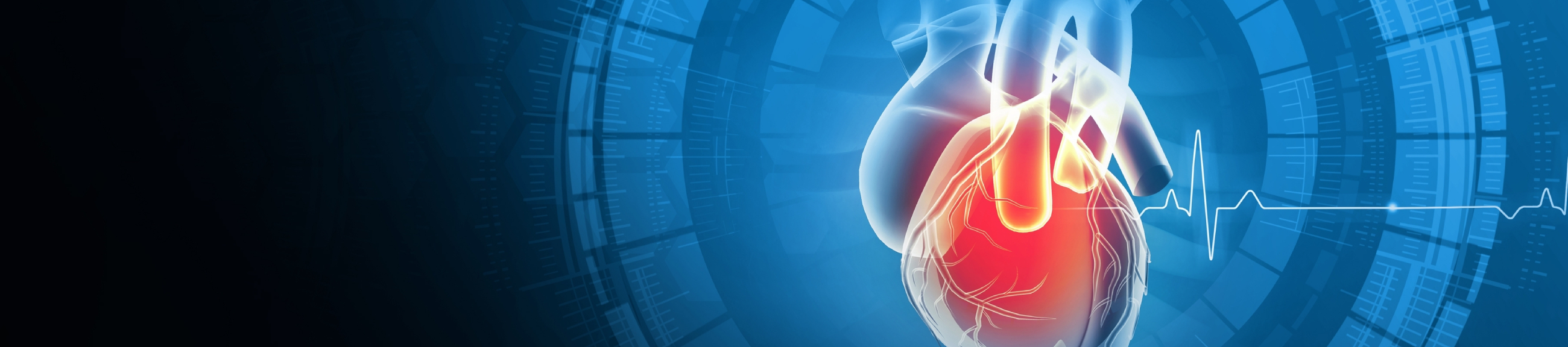 Καρδιοπάθειες