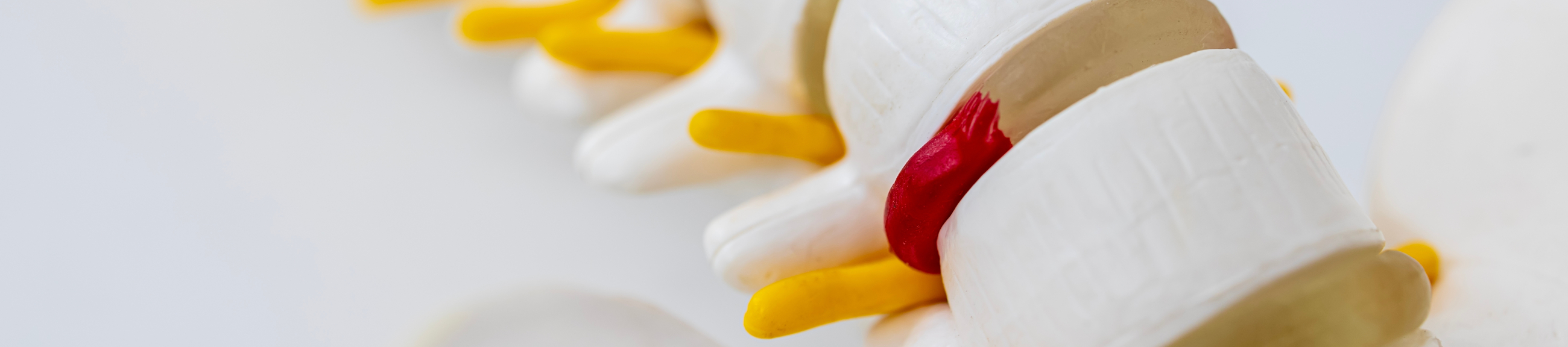 Διαδερμική αντιμετώπιση σκολίωσης