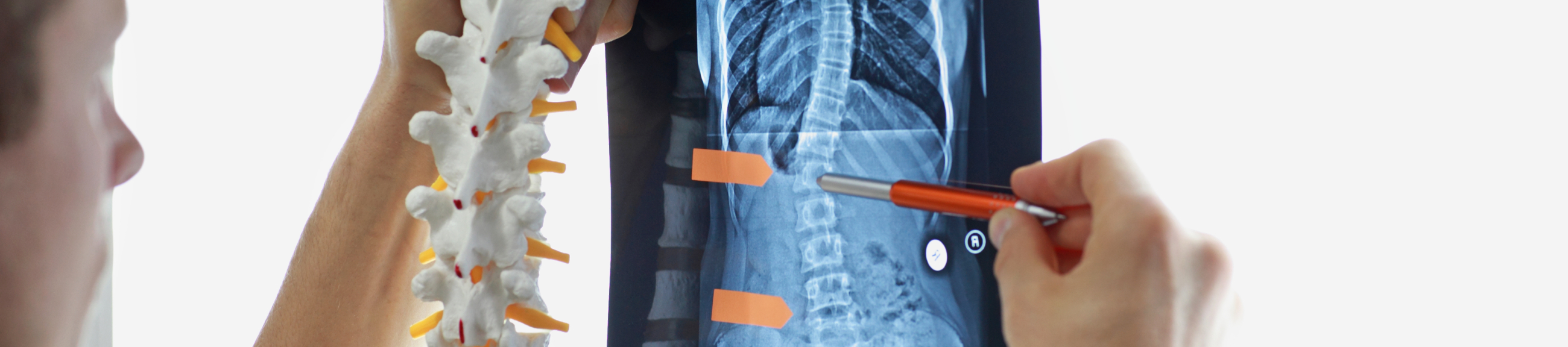 Σκολίωση και κύφωση: και αισθητικά και λειτουργικά ανώτερο αποτέλεσμα