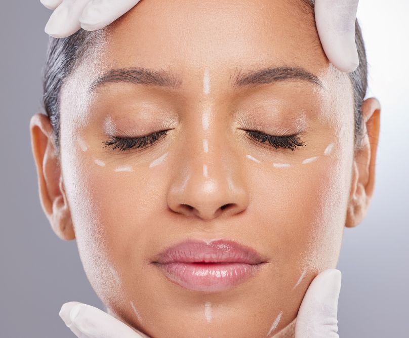 Βοτουλινική τοξίνη: 3 tips μετά τη θεραπεία για βέλτιστο αποτέλεσμα