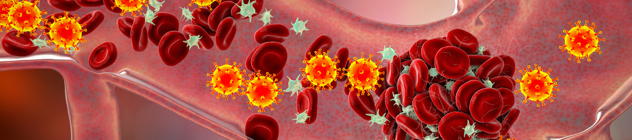 Aυξάνει η νόσος COVID-19 τον κίνδυνο θρόμβωσης;