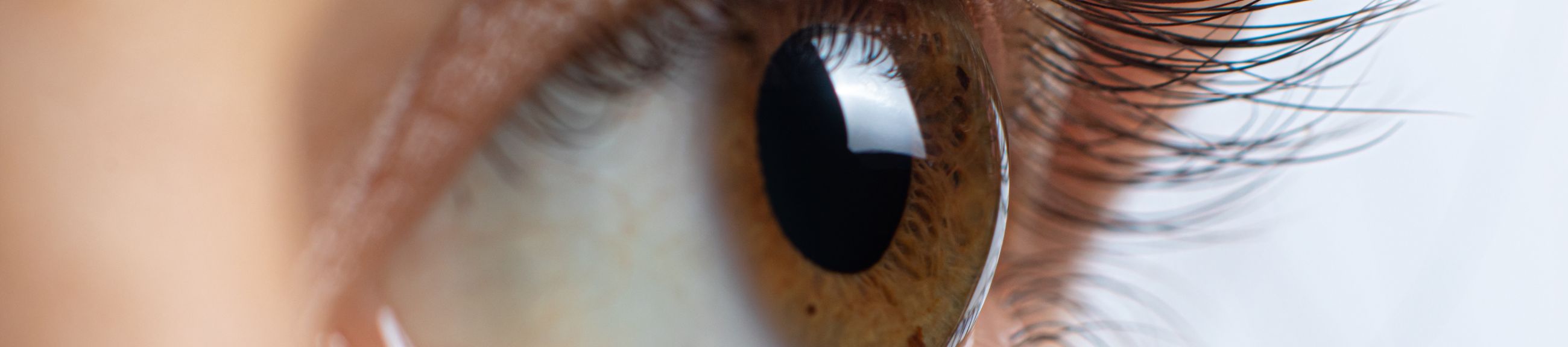 Μεταμόσχευση κερατοειδούς