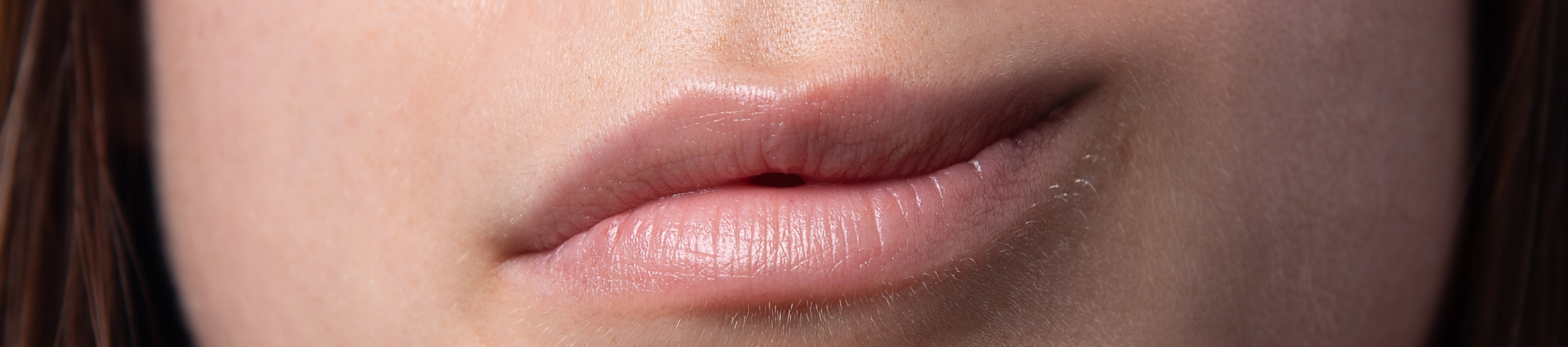 Παράλυση προσώπου