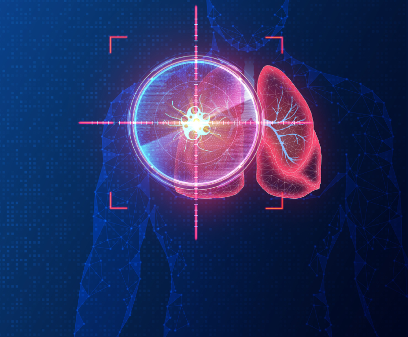 Επεμβατική Ακτινολογία: ερωτήσεις & απαντήσεις, εφαρμογές & προοπτικές