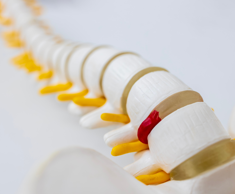 Διαδερμική αντιμετώπιση σκολίωσης