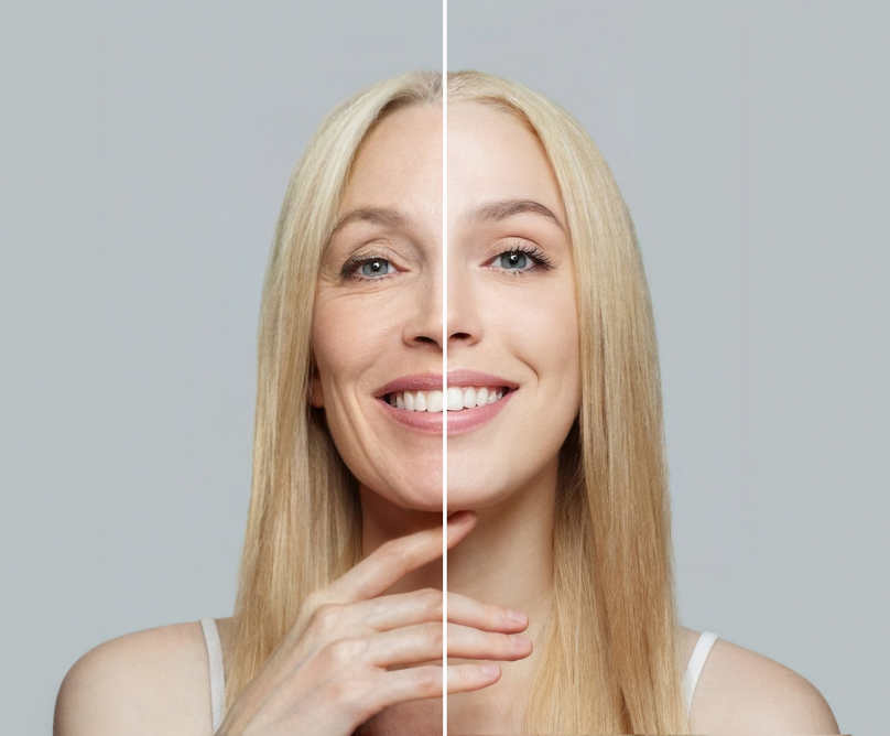 Ορμονοθεραπεία εναντίον της γήρανσης