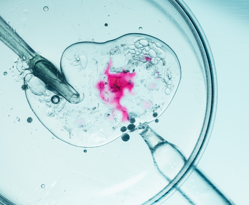 Εξωσωματική γονιμοποίηση