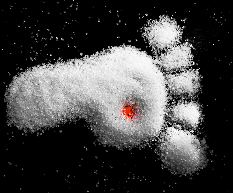 Διαβητικό πόδι: τι είναι, πώς προκαλείται, πώς αντιμετωπίζεται