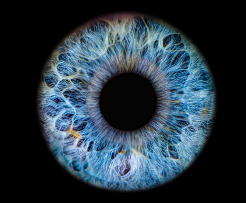 Διαβητική αμφιβληστροειδοπάθεια