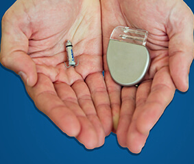 Βηματοδότης χωρίς ηλεκτρόδια (leadless pacemaker): Μικρότερο μέγεθος, μεγαλύτερη ευελιξία