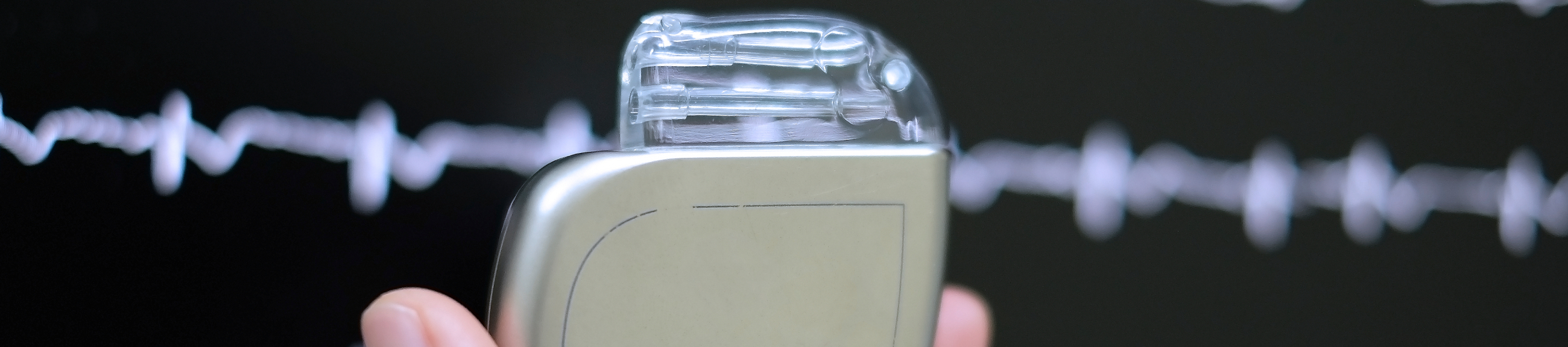 Βηματοδότης χωρίς ηλεκτρόδια