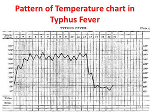 Υπόδειγμα διαγράμματος θερμοκρασίας πυρετού τύφου
