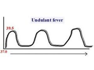 Κυματοειδής πυρετός