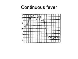 Συνεχής πυρετός