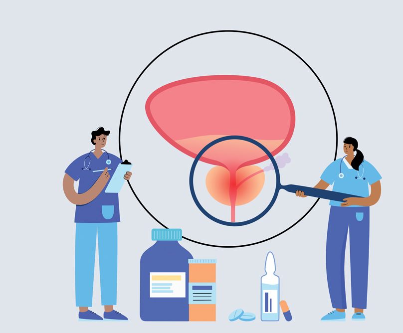 Θεραπεία της υπερτροφίας του προστάτη χωρίς φάρμακα, χωρίς χειρουργείο και χωρίς επιπτώσεις στη σεξουαλική λειτουργία