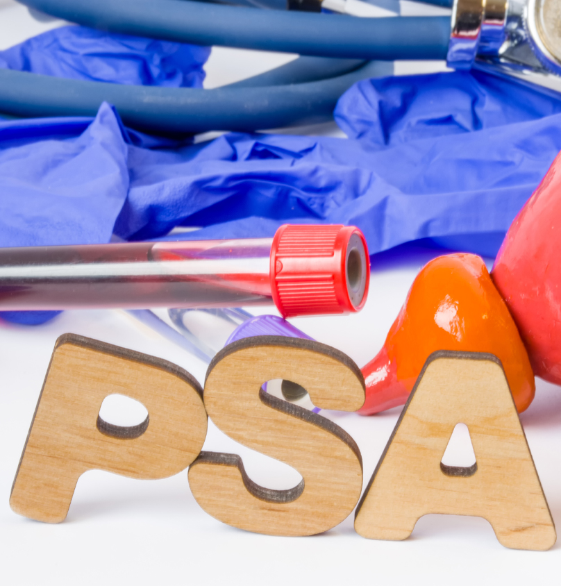 Τι είναι το PSA; 1 + 7 άλλες απαντήσεις στις απορίες σας