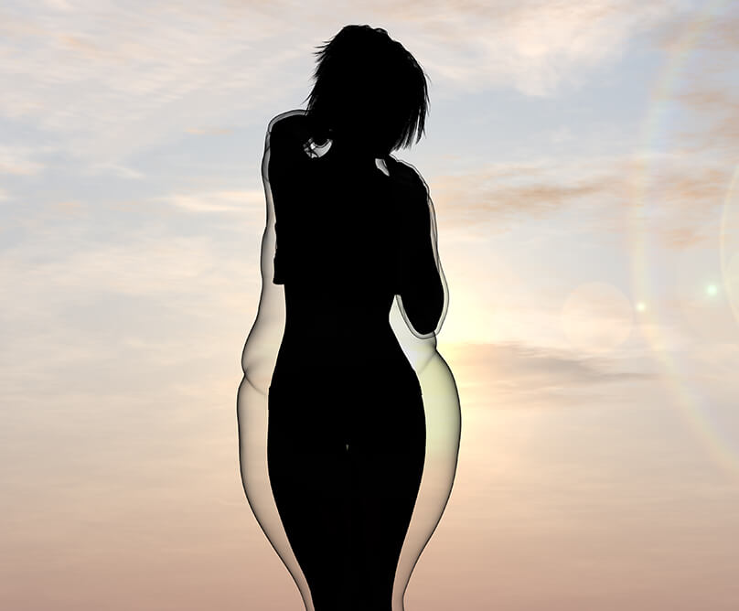 Λαπαροσκοπική γαστρική πτύχωση