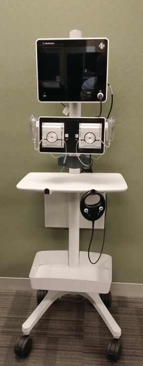 OS TEOCOOL TM, RadioFrequency minimal invasive thermal ablation