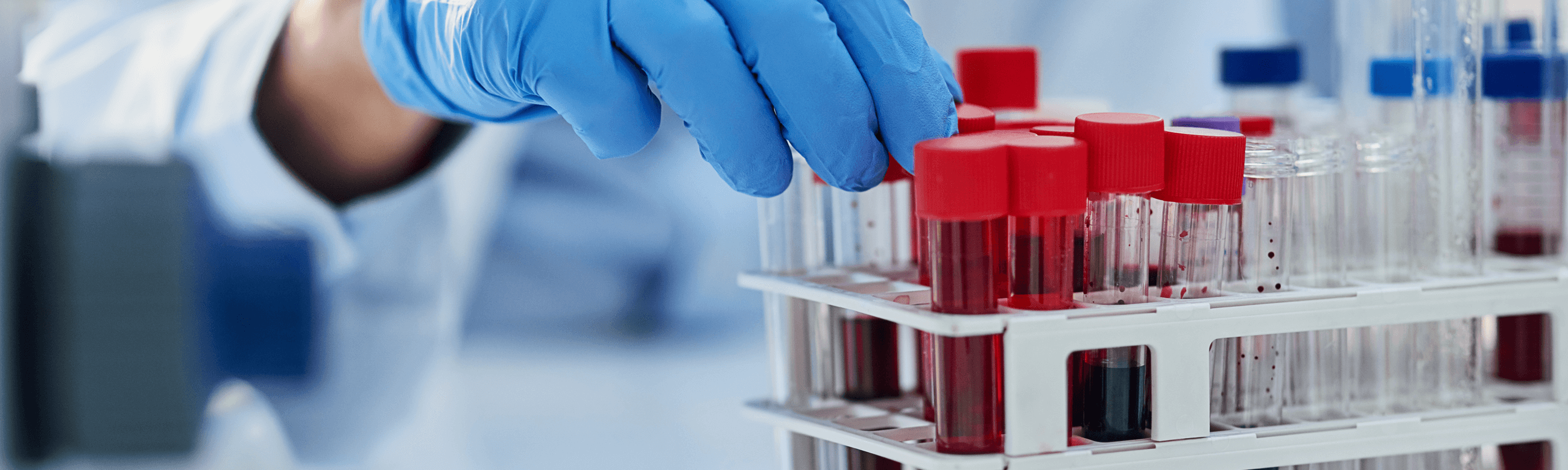 Γενική Αίματος & Βιοχημικός Έλεγχος